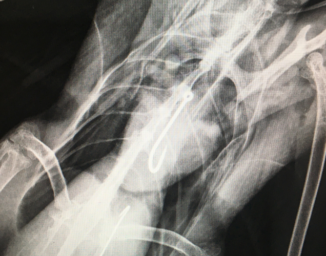 Cormorant X-Ray